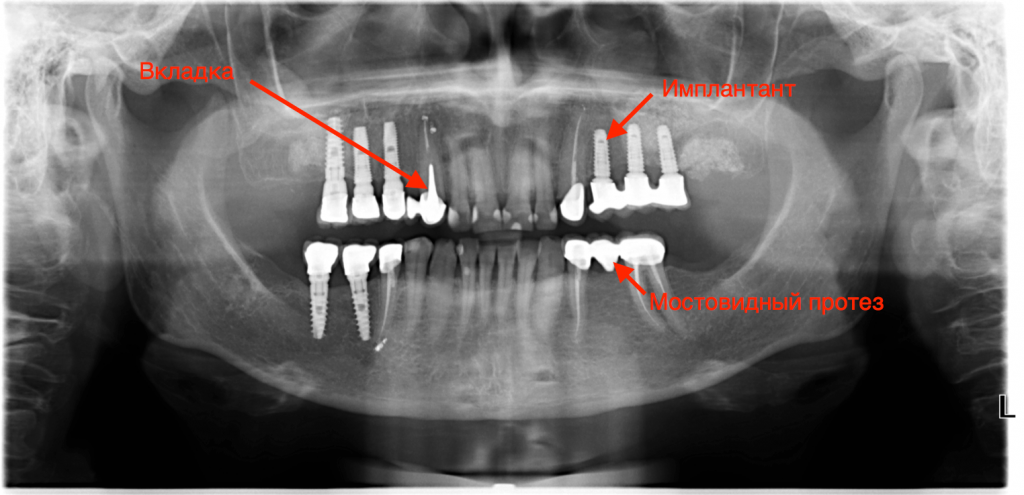 Первичный прием стоматолога в Тюмени в удобное время