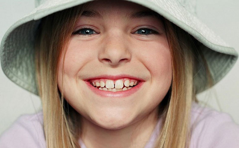 Профессиональный осмотр полости рта у детей в стоматологии Дентал-Люкс сохранит зубки ваших детей здоровыми и крепкими.