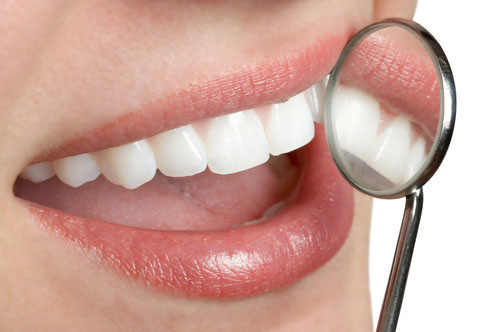 квалифицированные специалисты и минимальная за удаление зубного камня цена в Дентал-люкс