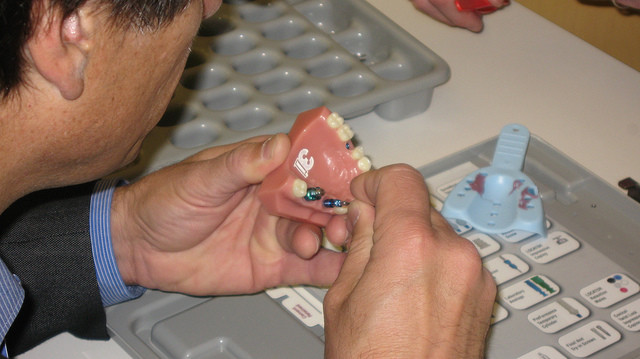 Имплантология зубов весьма успешно используется в клинике «Дентал Люкс» 